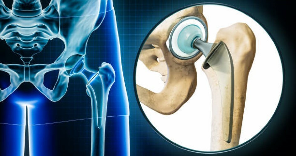 Technologie wytwarzania implantów i narzędzi medycznych